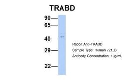 TRABD Antibody, Novus Biologicals 100 &mu;L | Buy Online | Novus Biologicals | Fisher Scientific